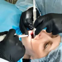 Sedasyon uygulaması ile diş tedavisi olan hasta.