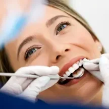 Diş hekimi, ön dişe estetik dolgu (bonding) uyguluyor, doğal renk ve şekil geri kazanılıyor