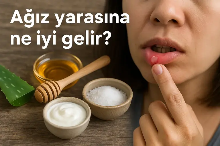 Ağız yarasına iyi gelen doğal çözümler: aloe vera, tuzlu su, bal, karbonat, karanfil yağı, adaçayı, zerdeçal görseli
