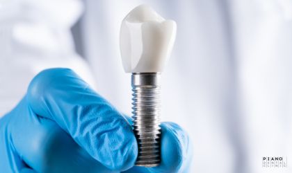 Ankara implant tedavisi Piano Dental Clinic
