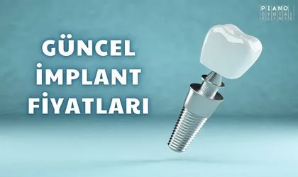 2025 Yılı Güncel İmplant Fiyatları Listesi