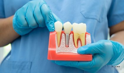 İmplant tedavisi süreci Ankara Piano Dental Clinic