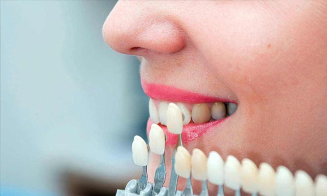 Kanal Tedavisi Tekrarı ( Retreatment )