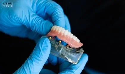 sabit protezler | Piano Dental Clinic | Estetik Diş Hekimliği | Dental İmplantlar sabit protetik tedaviler ve sabit diş protezi görseli