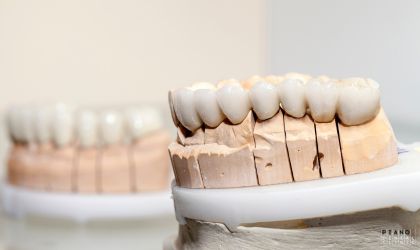 Zirkonyum diş kaplama Ankara Piano Dental Clinic